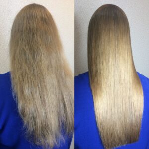 پلکس تراپی چیست